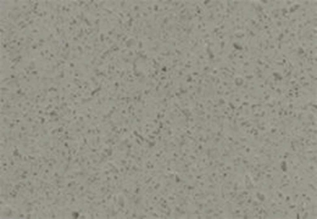 Gray speckled stone texture